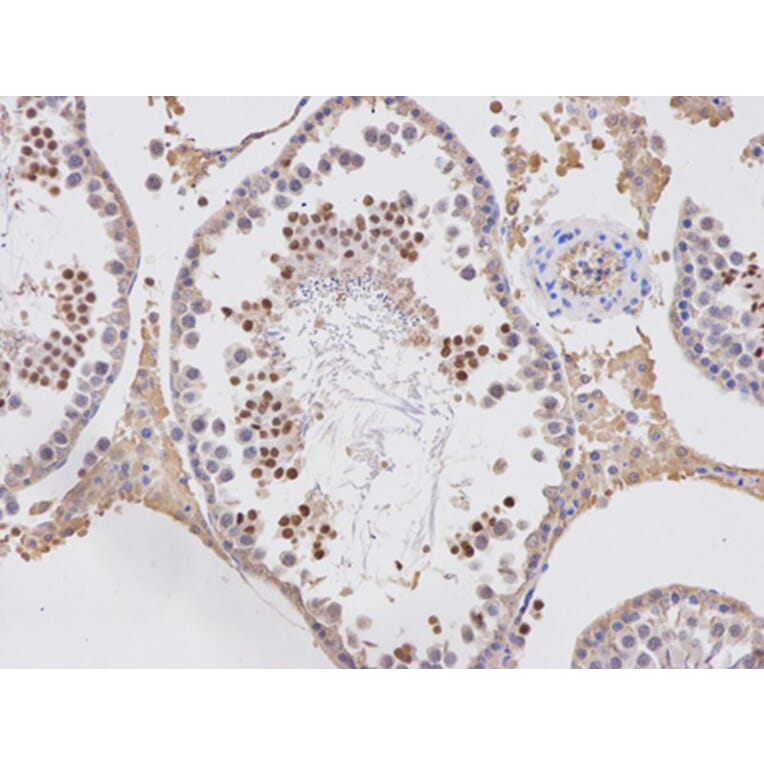 Immunohistochemistry - APOBEC3G Antibody from Signalway Antibody (32283) - Antibodies.com
