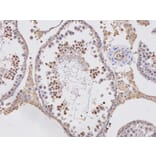 Immunohistochemistry - APOBEC3G Antibody from Signalway Antibody (32283) - Antibodies.com
