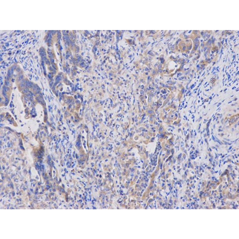 Immunohistochemistry - APOBEC3G Antibody from Signalway Antibody (32283) - Antibodies.com