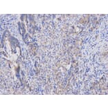 Immunohistochemistry - APOBEC3G Antibody from Signalway Antibody (32283) - Antibodies.com