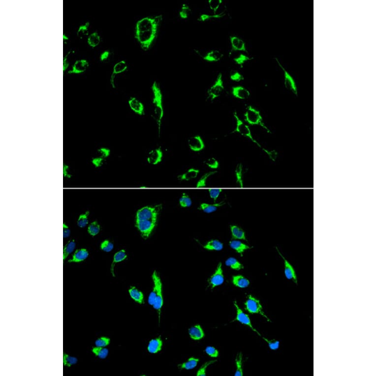 Immunofluorescence - APOBEC3G Antibody from Signalway Antibody (32283) - Antibodies.com