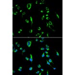 Immunofluorescence - APOBEC3G Antibody from Signalway Antibody (32283) - Antibodies.com