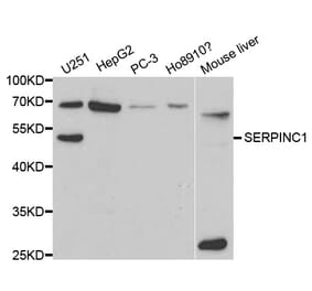 Western blot - SERPINC1 Antibody from Signalway Antibody (32319) - Antibodies.com