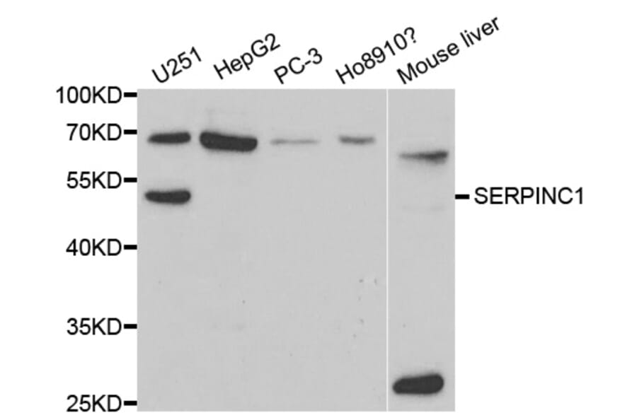 Western blot - SERPINC1 Antibody from Signalway Antibody (32319) - Antibodies.com