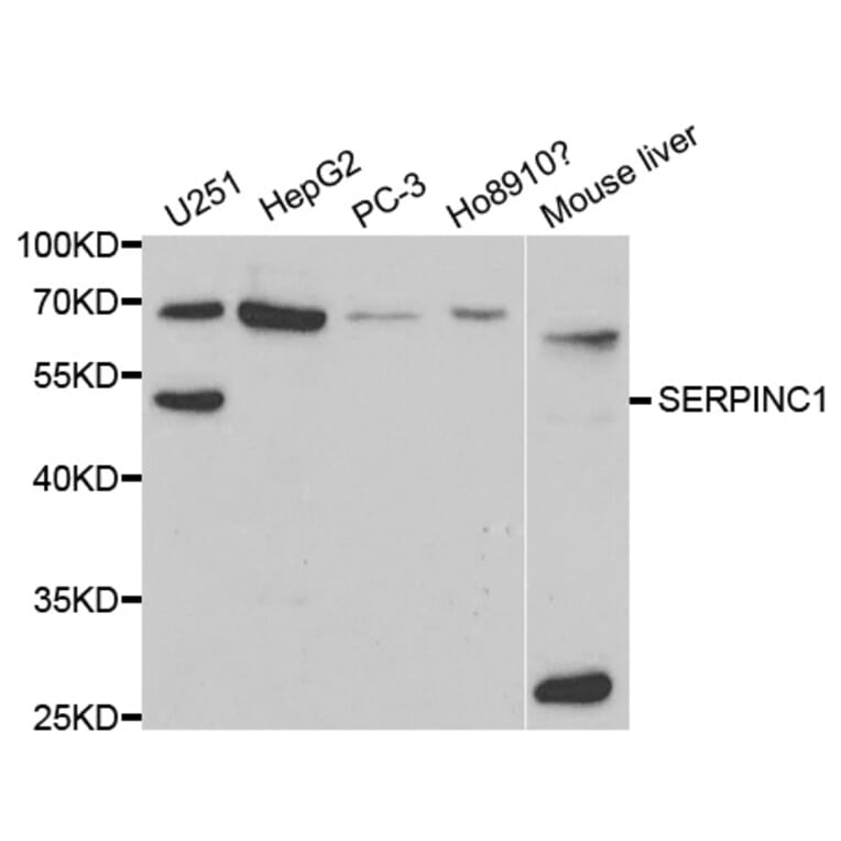 Western blot - SERPINC1 Antibody from Signalway Antibody (32319) - Antibodies.com