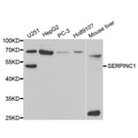 Western blot - SERPINC1 Antibody from Signalway Antibody (32319) - Antibodies.com