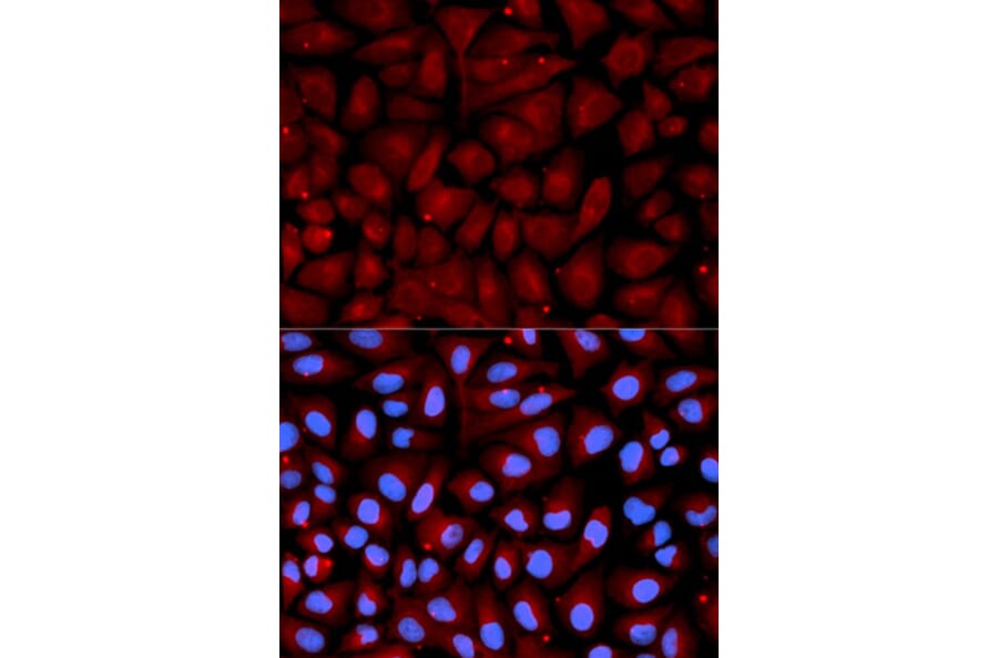 Immunofluorescence - SERPINC1 Antibody from Signalway Antibody (32319) - Antibodies.com
