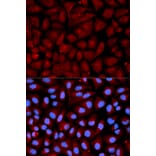 Immunofluorescence - SERPINC1 Antibody from Signalway Antibody (32319) - Antibodies.com