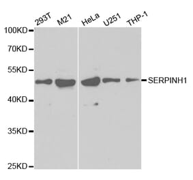 Western blot - SERPINH1 Antibody from Signalway Antibody (32687) - Antibodies.com