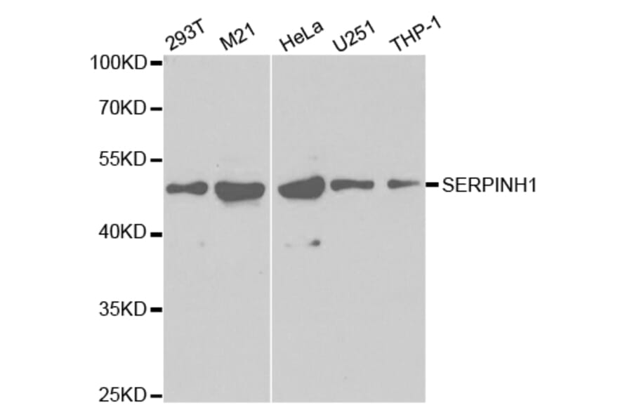 Western blot - SERPINH1 Antibody from Signalway Antibody (32687) - Antibodies.com