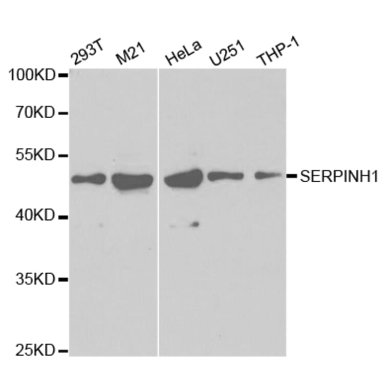 Western blot - SERPINH1 Antibody from Signalway Antibody (32687) - Antibodies.com