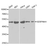Western blot - SERPINH1 Antibody from Signalway Antibody (32687) - Antibodies.com