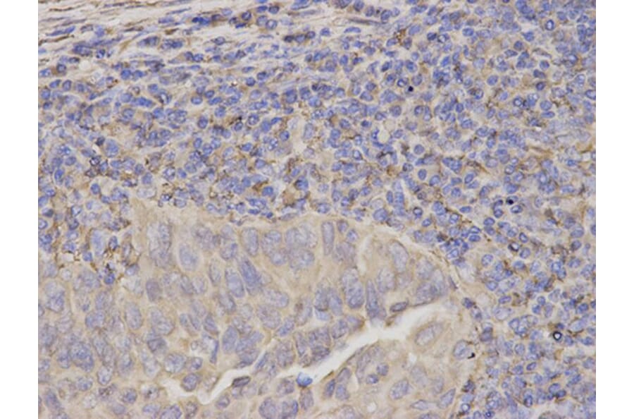 Immunohistochemistry - SERPINH1 Antibody from Signalway Antibody (32687) - Antibodies.com