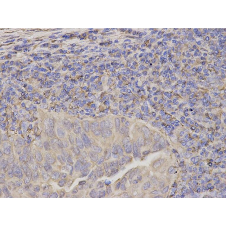 Immunohistochemistry - SERPINH1 Antibody from Signalway Antibody (32687) - Antibodies.com