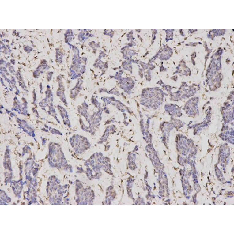 Immunohistochemistry - SERPINH1 Antibody from Signalway Antibody (32687) - Antibodies.com