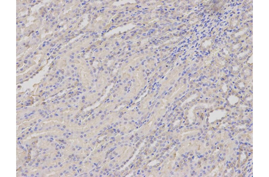 Immunohistochemistry - SERPINH1 Antibody from Signalway Antibody (32687) - Antibodies.com