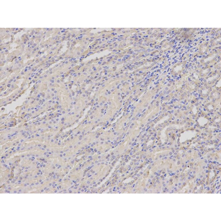 Immunohistochemistry - SERPINH1 Antibody from Signalway Antibody (32687) - Antibodies.com