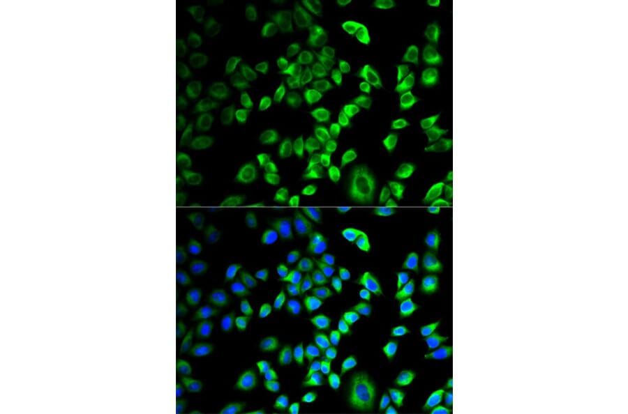 Immunofluorescence - SERPINH1 Antibody from Signalway Antibody (32687) - Antibodies.com