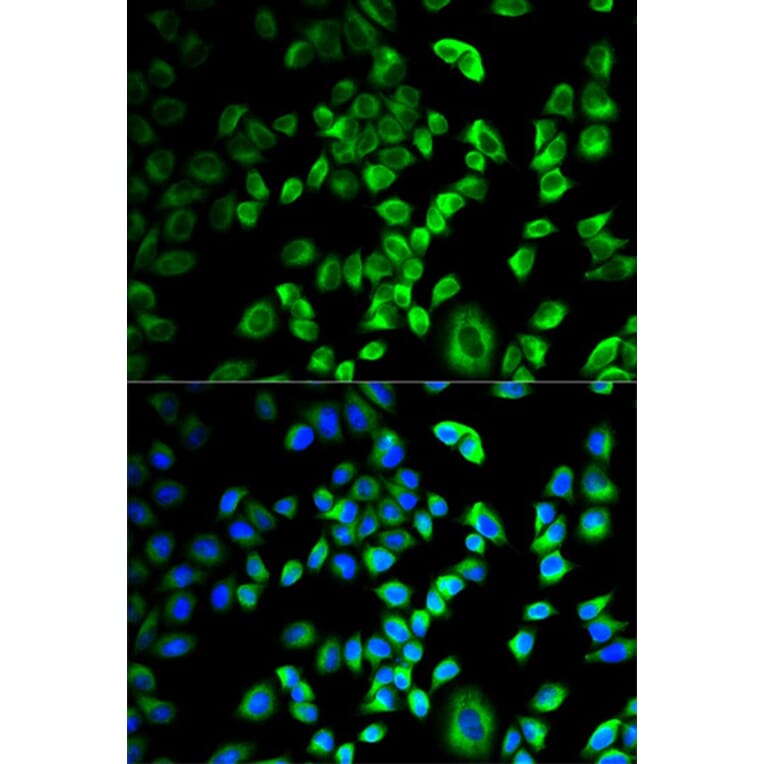 Immunofluorescence - SERPINH1 Antibody from Signalway Antibody (32687) - Antibodies.com
