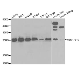 Western blot - HSD17B10 Antibody from Signalway Antibody (32854) - Antibodies.com