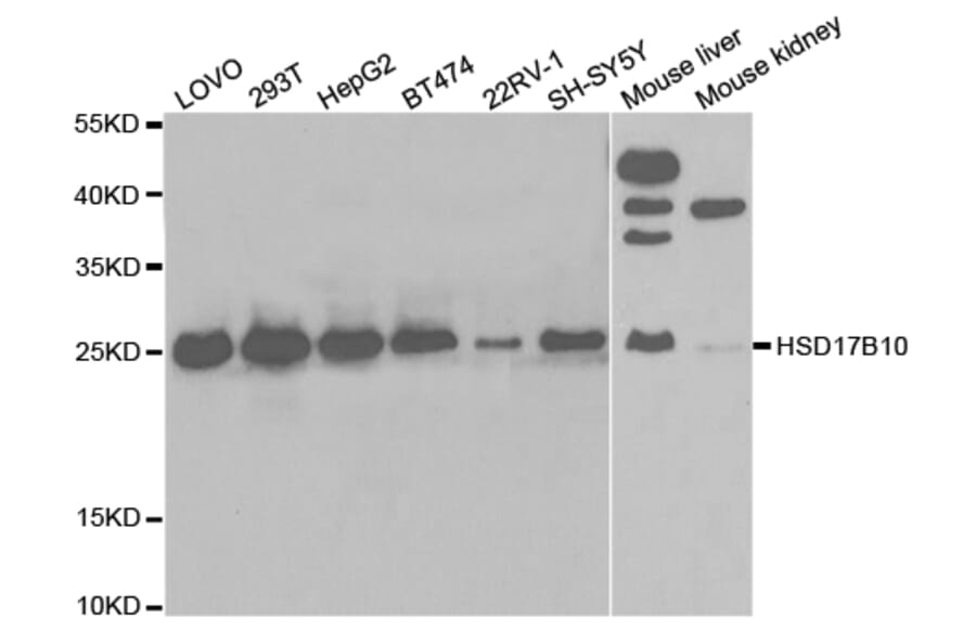 Western blot - HSD17B10 Antibody from Signalway Antibody (32854) - Antibodies.com