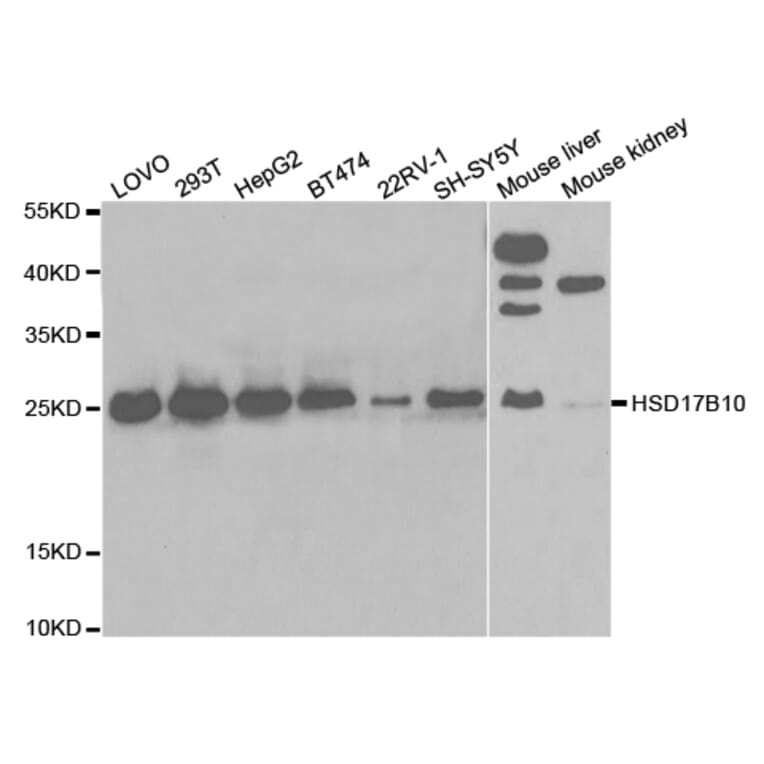 Western blot - HSD17B10 Antibody from Signalway Antibody (32854) - Antibodies.com