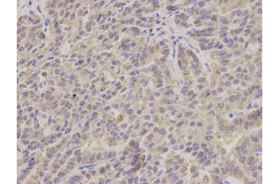 Immunohistochemistry - HSD17B10 Antibody from Signalway Antibody (32854) - Antibodies.com
