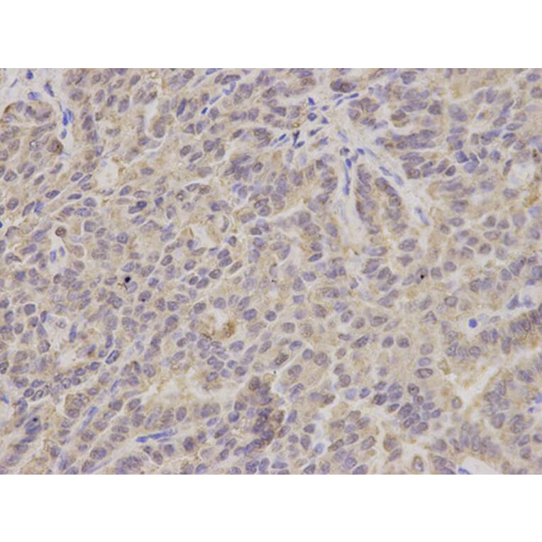 Immunohistochemistry - HSD17B10 Antibody from Signalway Antibody (32854) - Antibodies.com