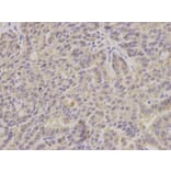 Immunohistochemistry - HSD17B10 Antibody from Signalway Antibody (32854) - Antibodies.com