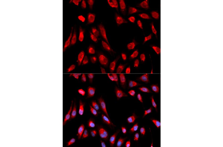 Immunofluorescence - HSD17B10 Antibody from Signalway Antibody (32854) - Antibodies.com