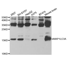 Western blot - MAP1LC3A Antibody from Signalway Antibody (32926) - Antibodies.com