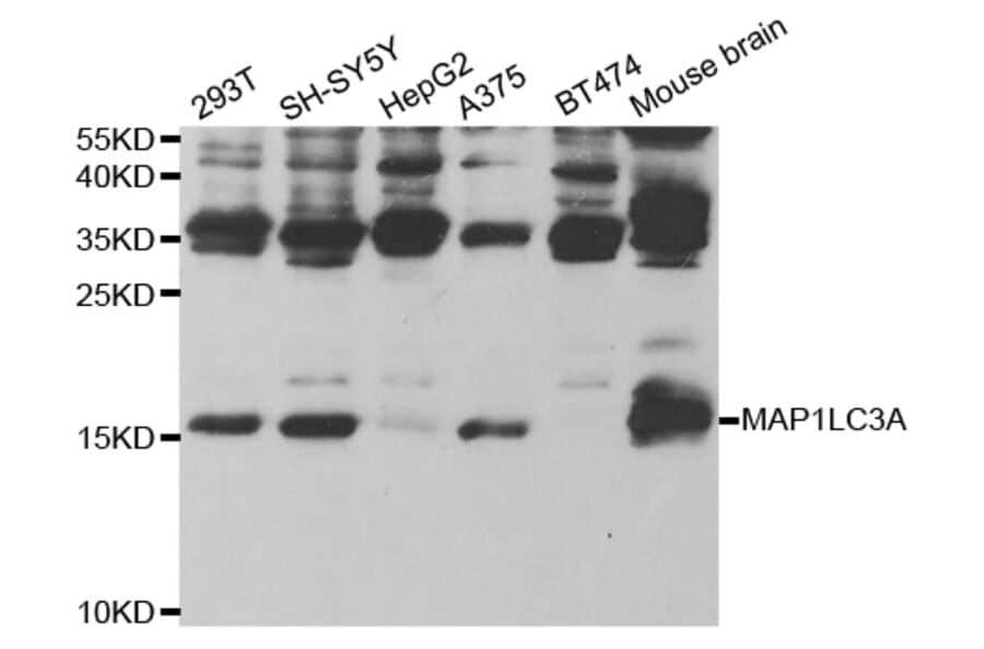 Western blot - MAP1LC3A Antibody from Signalway Antibody (32926) - Antibodies.com
