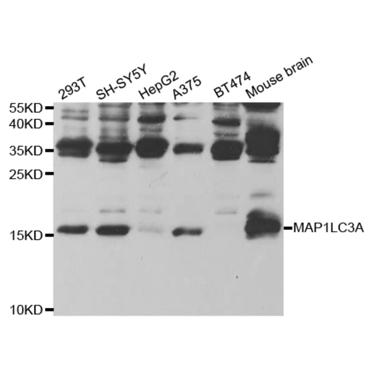 Western blot - MAP1LC3A Antibody from Signalway Antibody (32926) - Antibodies.com