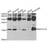 Western blot - MAP1LC3A Antibody from Signalway Antibody (32926) - Antibodies.com