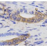 Immunohistochemistry - MAP1LC3A Antibody from Signalway Antibody (32926) - Antibodies.com