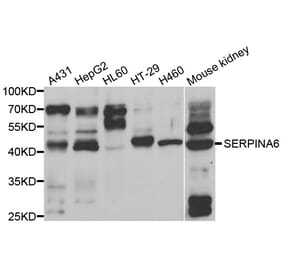 Western blot - SERPINA6 Antibody from Signalway Antibody (33055) - Antibodies.com