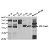 Western blot - SERPINA6 Antibody from Signalway Antibody (33055) - Antibodies.com