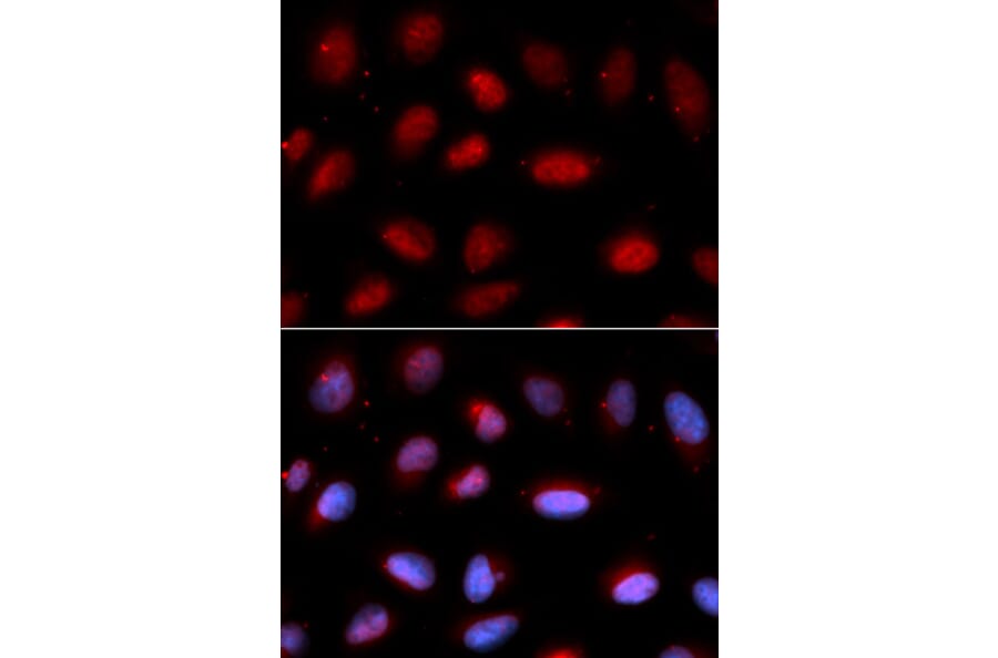 Immunofluorescence - SERPINA6 Antibody from Signalway Antibody (33055) - Antibodies.com
