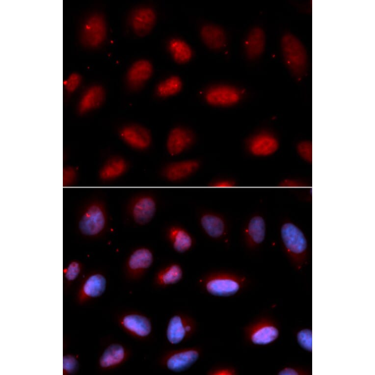 Immunofluorescence - SERPINA6 Antibody from Signalway Antibody (33055) - Antibodies.com