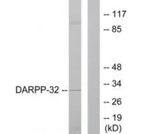 Western blot - DARPP-32 Antibody from Signalway Antibody (33116) - Antibodies.com