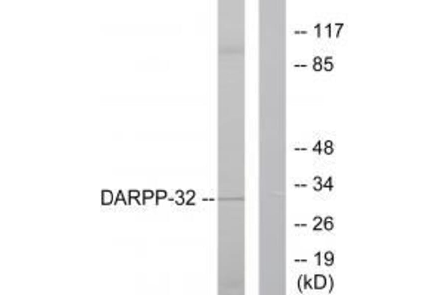 Western blot - DARPP-32 Antibody from Signalway Antibody (33116) - Antibodies.com
