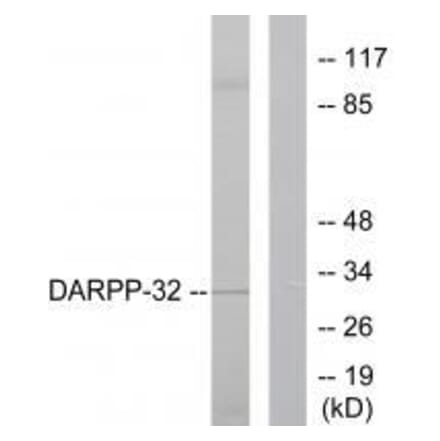 Western blot - DARPP-32 Antibody from Signalway Antibody (33116) - Antibodies.com