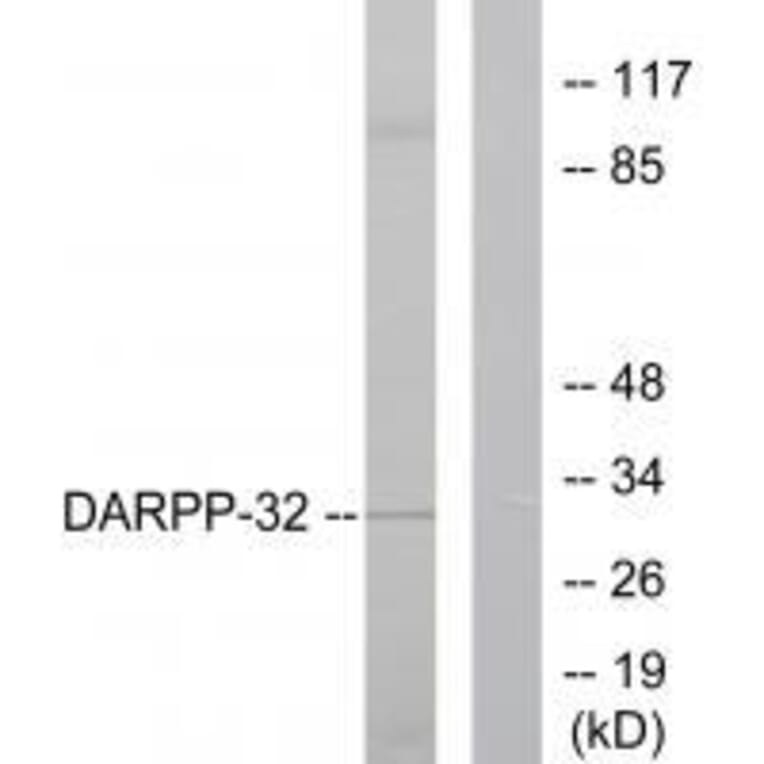 Western blot - DARPP-32 Antibody from Signalway Antibody (33116) - Antibodies.com