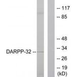 Western blot - DARPP-32 Antibody from Signalway Antibody (33116) - Antibodies.com