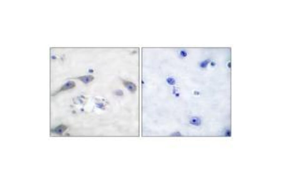 Immunohistochemistry - DARPP-32 Antibody from Signalway Antibody (33116) - Antibodies.com