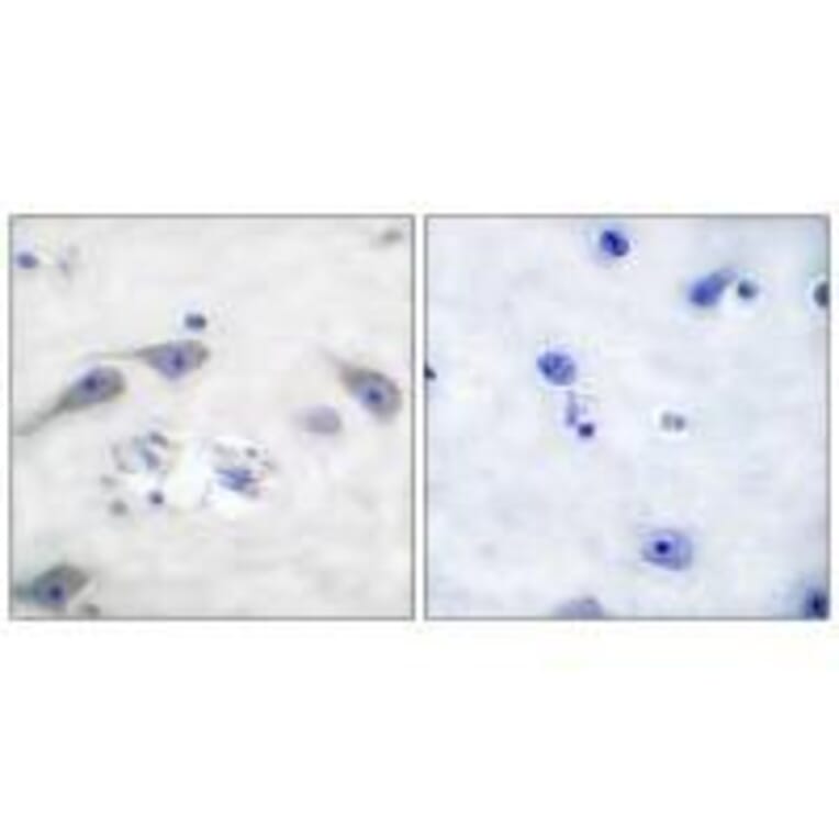 Immunohistochemistry - DARPP-32 Antibody from Signalway Antibody (33116) - Antibodies.com