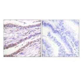 Immunohistochemistry - Cyclin A Antibody from Signalway Antibody (33349) - Antibodies.com