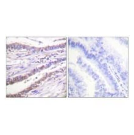Immunohistochemistry - Cyclin A Antibody from Signalway Antibody (33349) - Antibodies.com