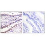 Immunohistochemistry - Cyclin A Antibody from Signalway Antibody (33349) - Antibodies.com