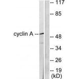 Western blot - Cyclin A Antibody from Signalway Antibody (33349) - Antibodies.com